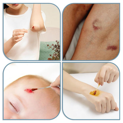 Snap-Activated Iodophor Swabs – Pre-Filled Portable Applicators